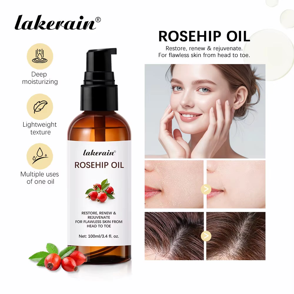 Organic Rosehip Oil Rose Hips Face Oils 30Ml Fast-Absorbing Skin Care Moisturizer Face Oil Organic Rosehip Seed Oil Essence