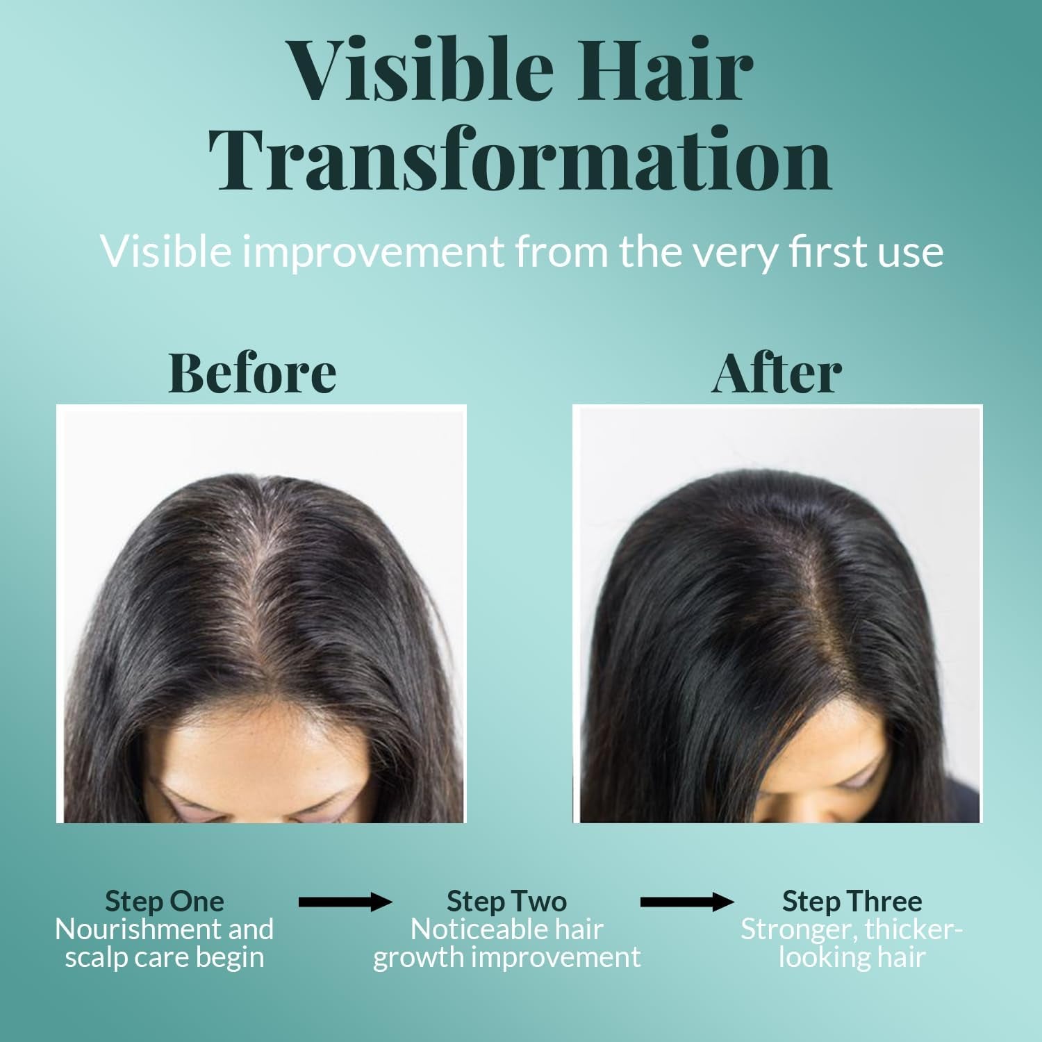 Rosemary Oil for Hair Growth Infused with Biotin, Jojoba & Castor Oil | Hair Strengthening Treatment | Nourishing & Volumizing | Non GMO Verified 120Ml (4Fl Oz)